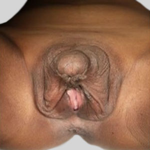 carlos j rios add pictures of women with large clitoris image