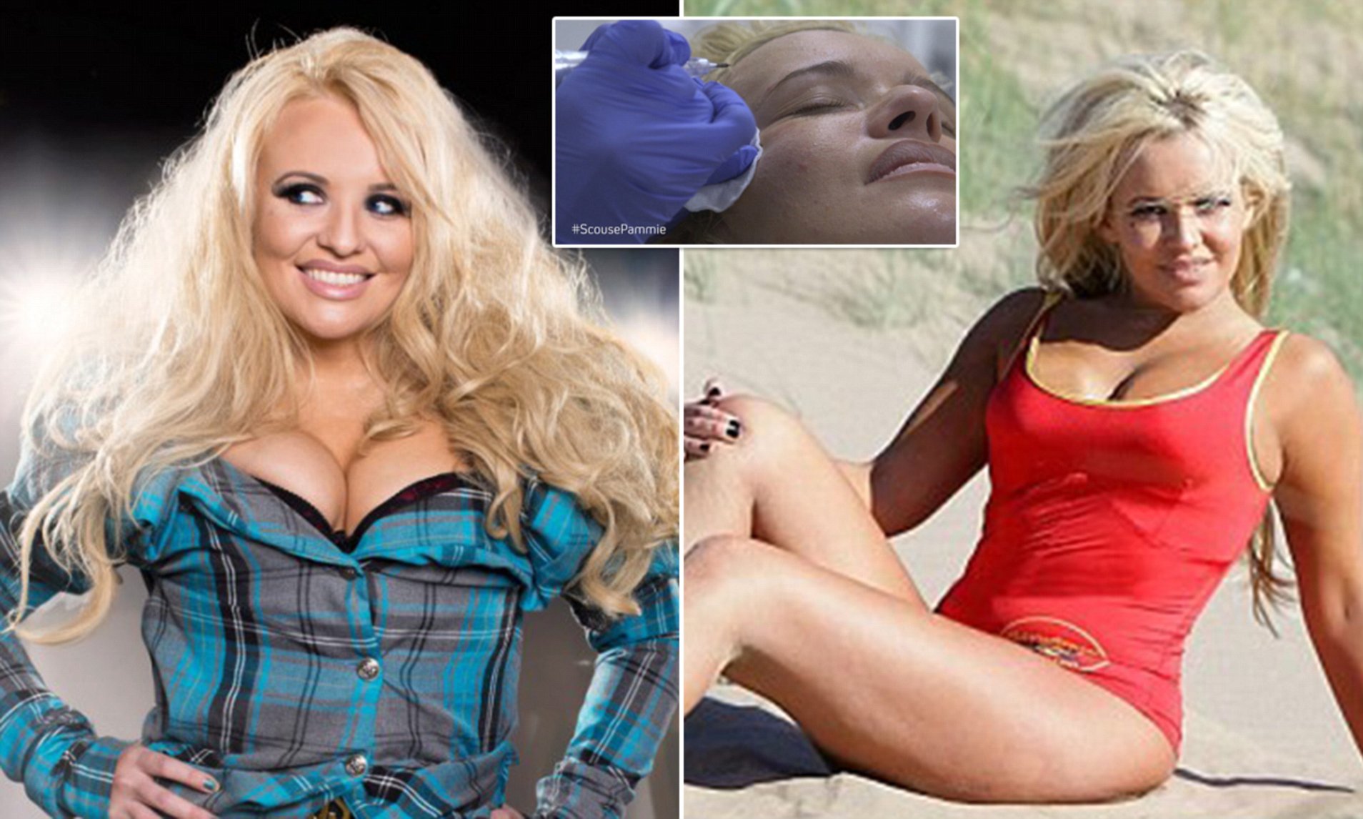 charl schoonraad add pamela anderson lookalike image