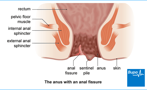 christopher brasel add anal pain face photo