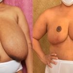 ana carolina hernandez add huge black mature tits image