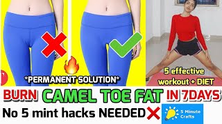 ased imtiaz butt add fattest camel toe photo