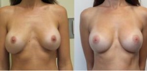 darren huang add great tits natural image