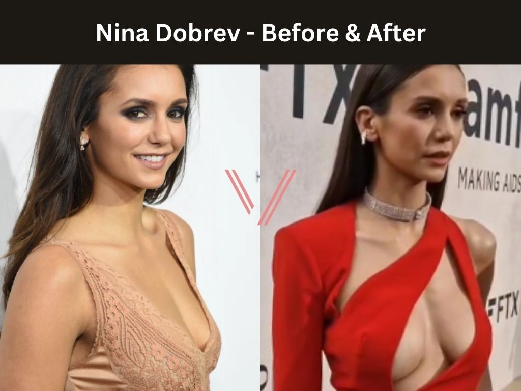 ayman rafiq add nina dobrev boobs photo